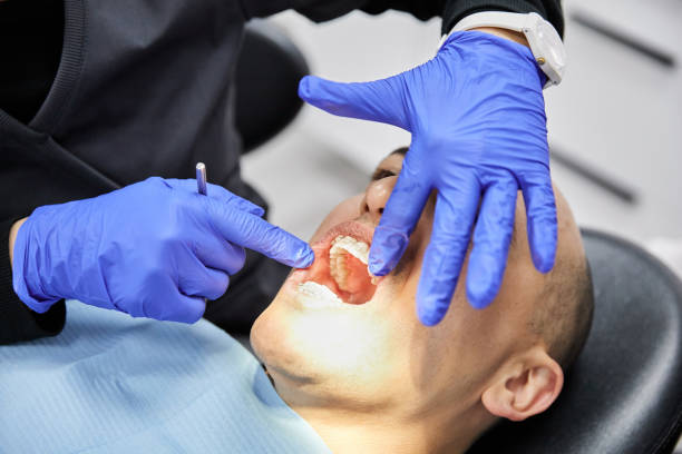 Best Emergency Wisdom Teeth Removal in Junction City, KY